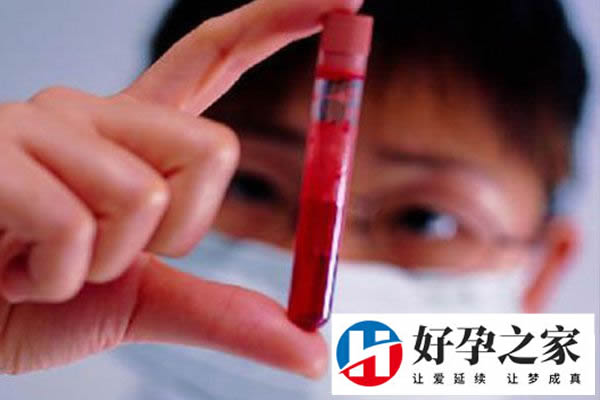 性激素六项和AMH有什么区别