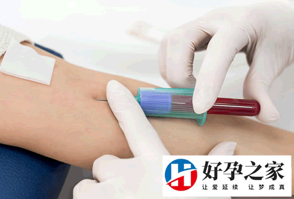 优生5项检查费用多少