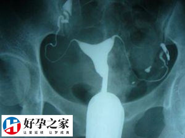 018f2053cb12e0b619a146cec08d42b1_1wpuqkp6Gl1723704957435.png