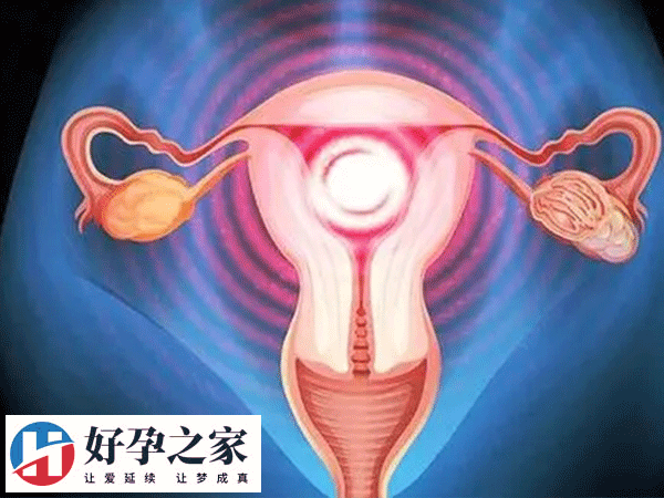 子宫内膜蠕动频繁可能影响试管成功率