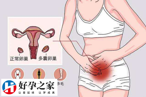 多囊加子宫内膜异位症适合的试管方案