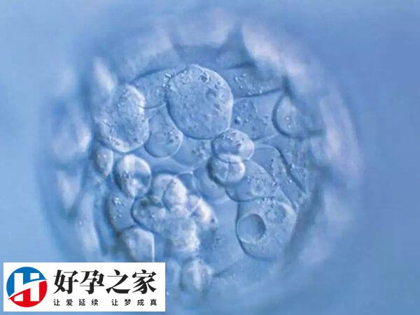 取卵第三天可进行鲜胚移植