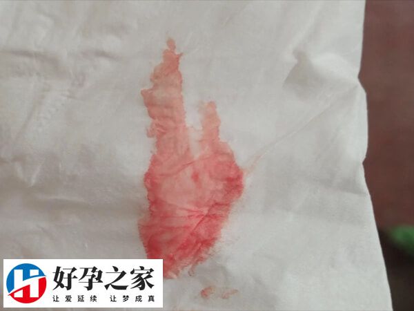 囊胚移植着床可能会出血