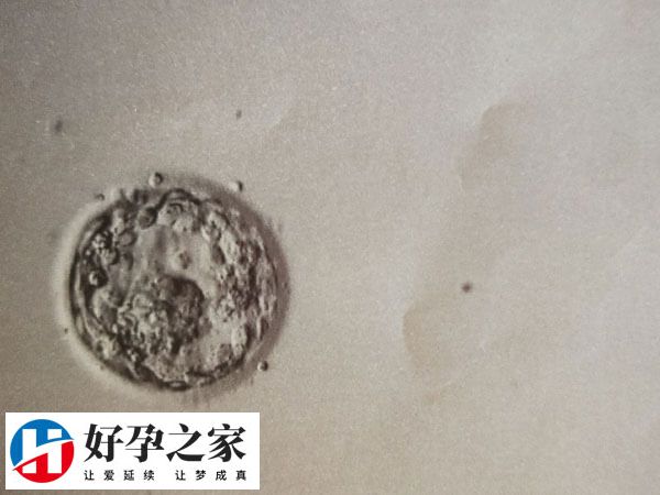 4cc囊胚移植成功率约30%