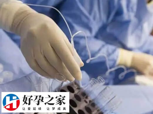 取卵失败后要总结原因