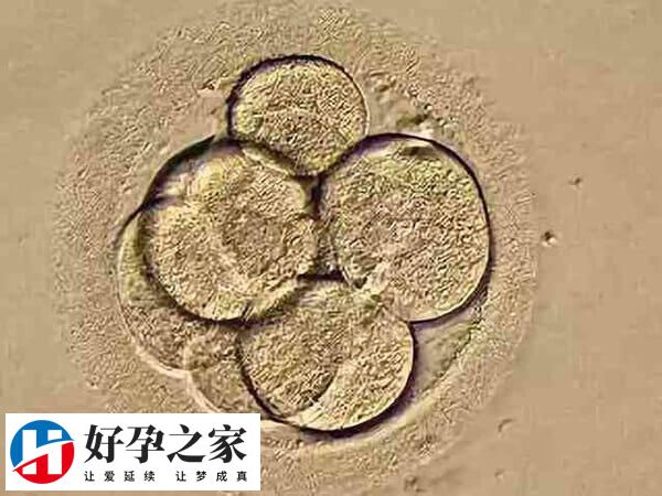 孕早期用药不当会增加畸形儿风险