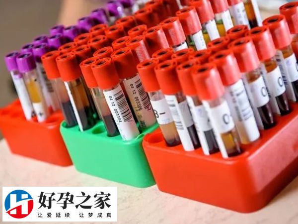 人授不成功转试管要补基础健康检查