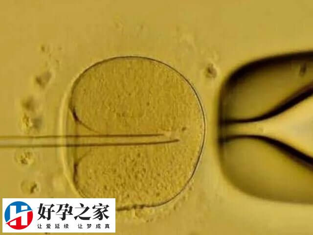 单囊胚移植可以在提高成功率