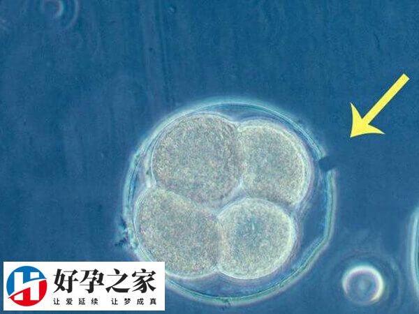 胚胎冷冻技术是辅助生殖技术的衍生技术