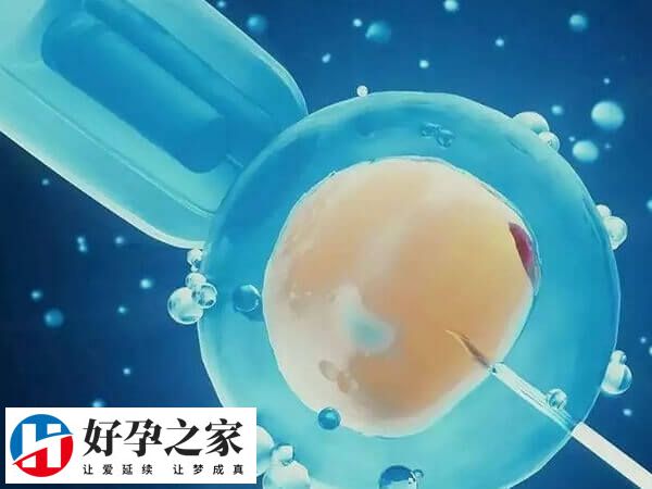 二代试管技术又叫ICSI