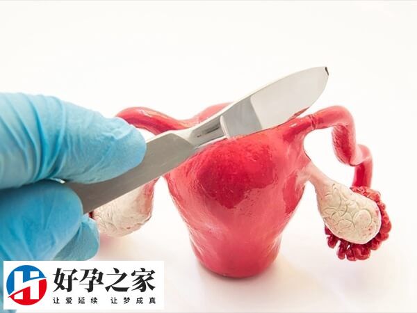 腺肌症切除子宫会导致月经停止