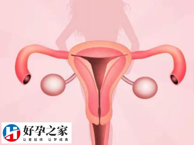 宫腔分离后成功率仍可达到60%以上