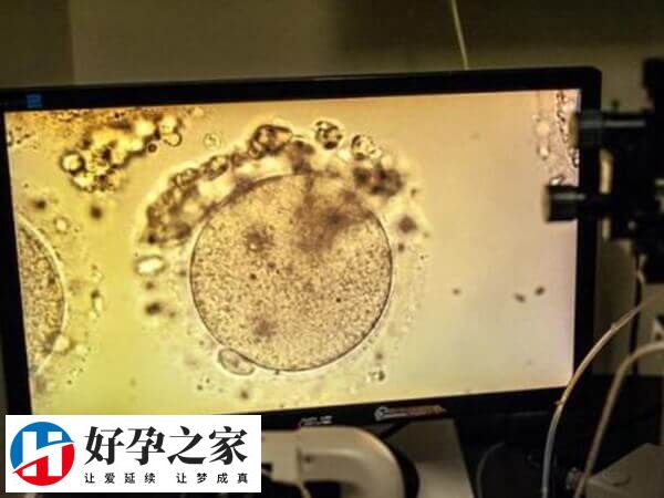 临床上平均约20%的卵子可能未成熟