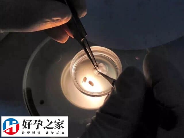 胚胎染色体非整倍体是一种较为复杂的情况