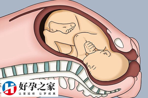 胎儿全入盆示意图